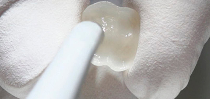 CARILLAS EDELWEISS CARILLAS EDELWEISS