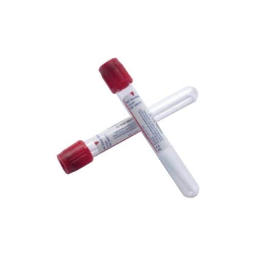 Fibrina Rica en Plaquetas O PRF