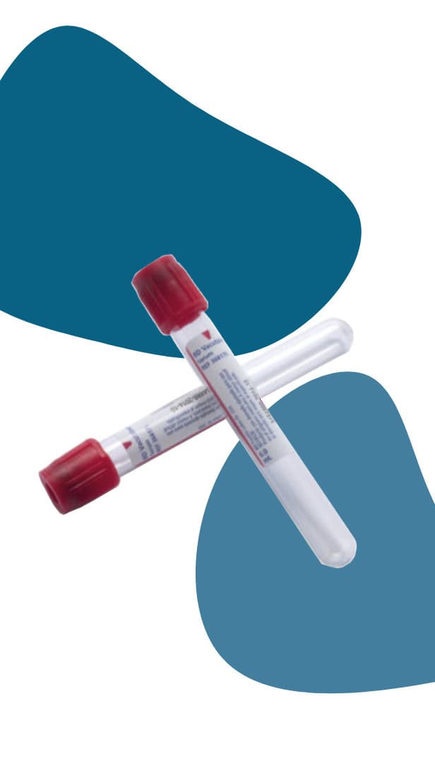 FIBRINA RICA EN PLAQUETAS BY KUBIDENT